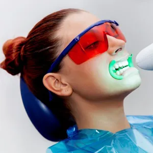 Studio odontoiatrico Minutoli - sbiancamento dentale 2