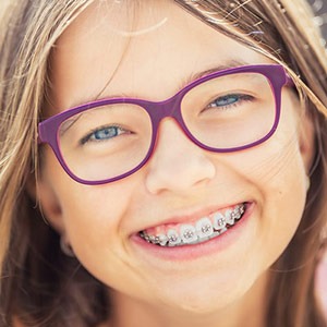 Minutoli Apparecchio ortodontico fisso